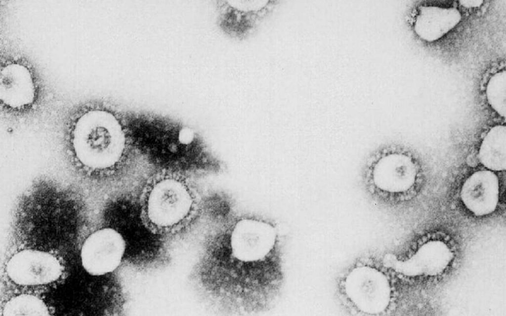 Coronavirus, variante “mai descritta in Italia”: rilevata a Napoli, le parole di De Luca